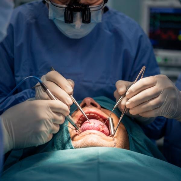 Advanced Tongue Cancer Treatment Options