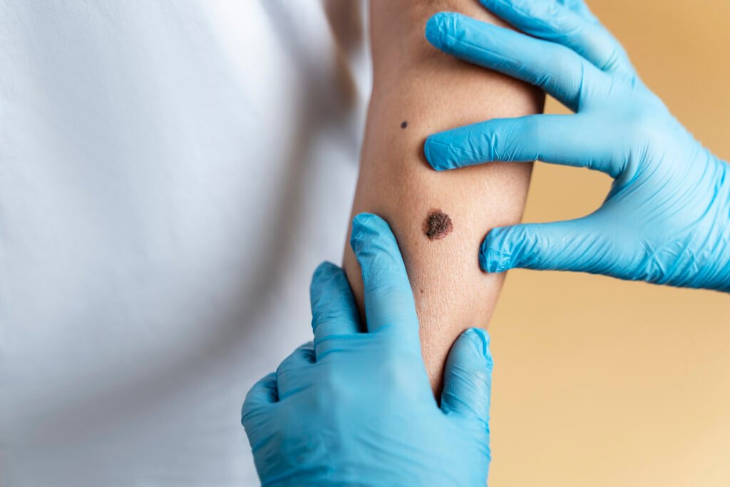 Comprehensive Skin Cancer Treatment