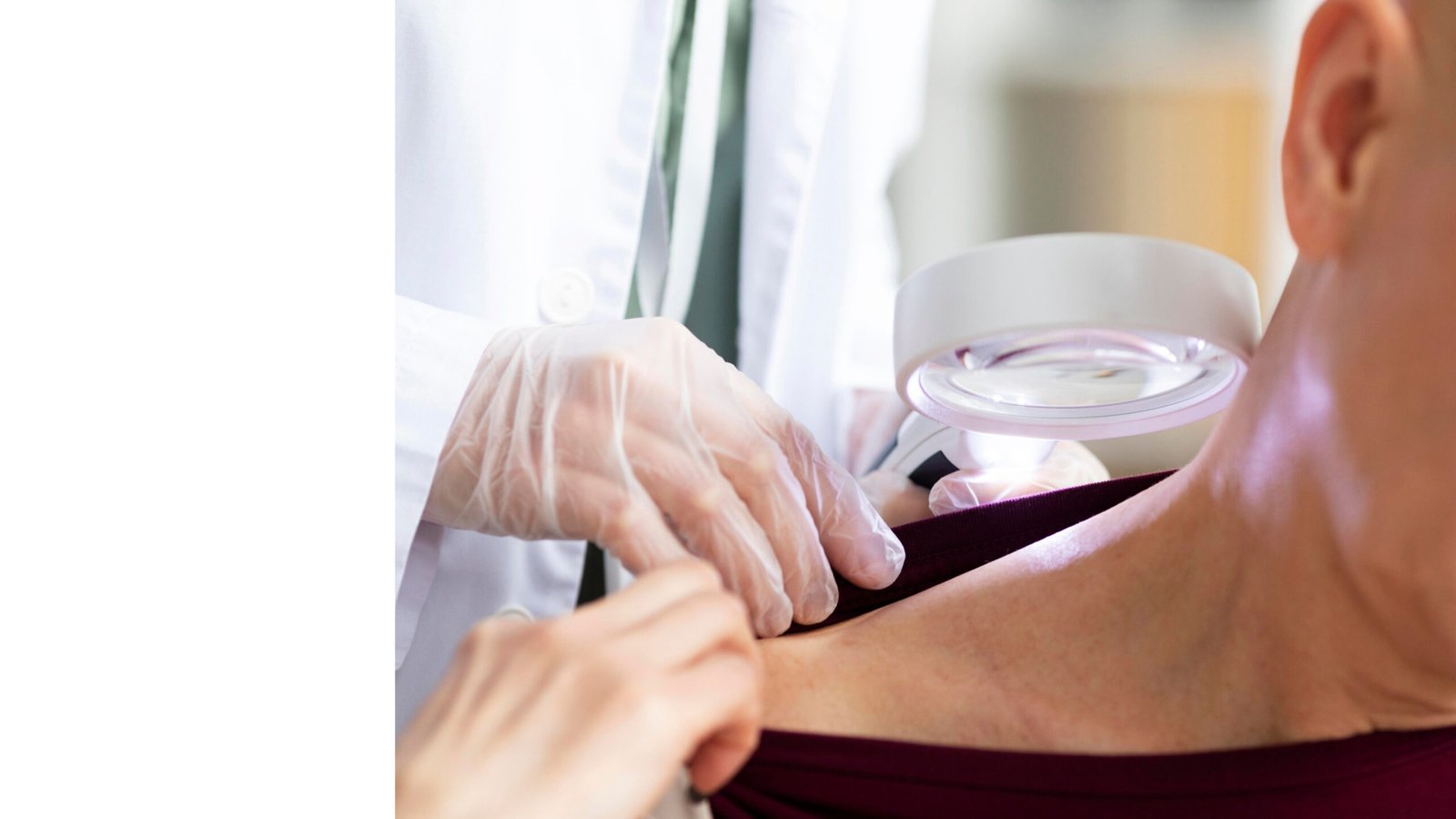 Skin Cancer Treatment in Gurgaon
